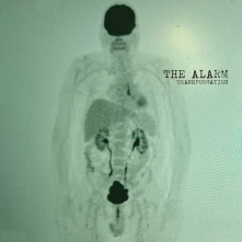 The Alarm, CD TRANSFORMATION