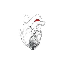 Vinyl SWANS - BEGGAR