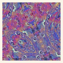CD PLACENTA